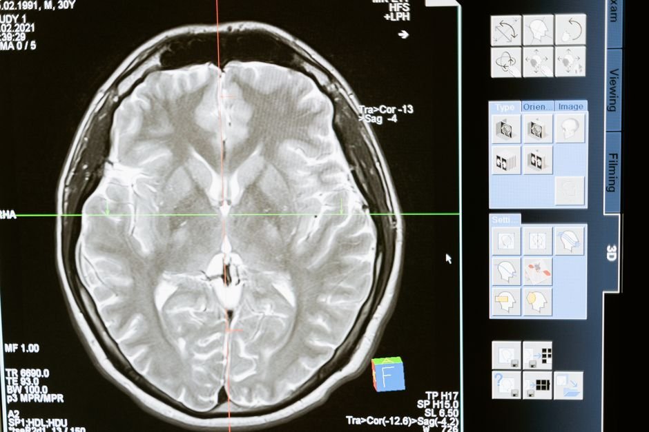 NeuroVFM: Pioneering AI for Clinical Neuroimaging with Uncurated Data