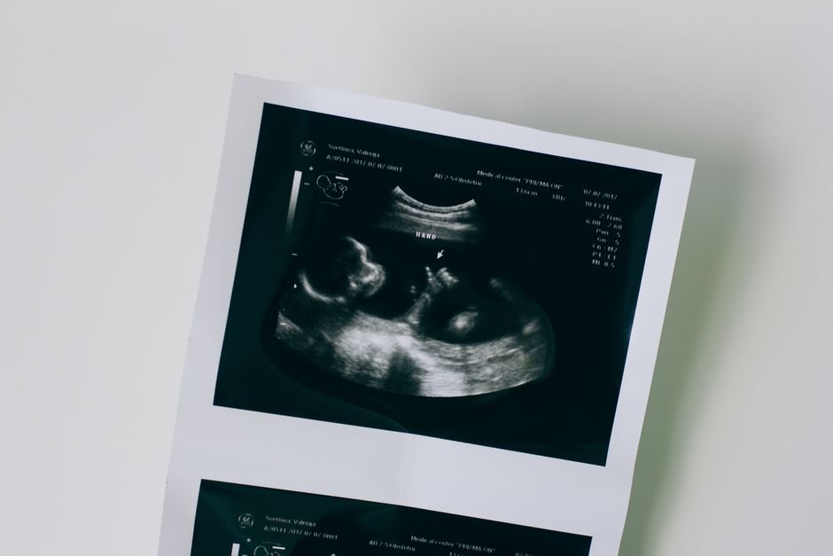 Revolutionizing Womb Cancer Checks: NHS Pioneers AI Blood Test