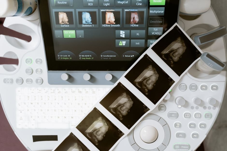 AI-Powered "Blind Sweeps": Revolutionizing Prenatal Ultrasound Access